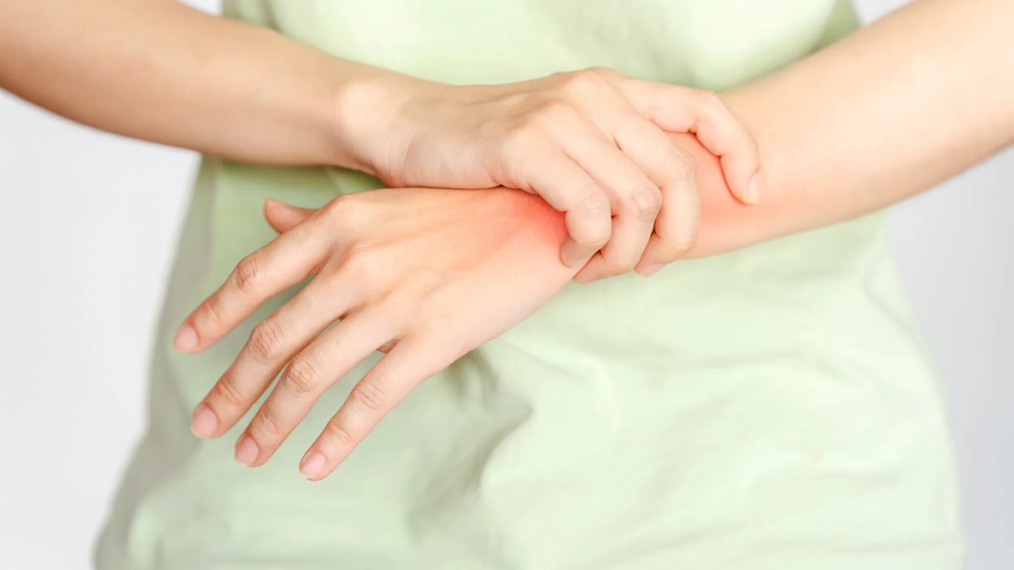 A person's right hand grasping their left wrist, which shows a prominent red, inflamed area on the skin, indicating pain or irritation.